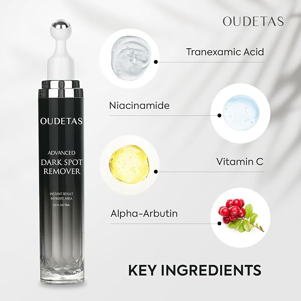 Pigmentflecken Entferner Gesicht Anti Pigment: Dark Spot Correcting Glow Serum mit Niacinamid & Vitamin C – Hyperpigmentierung Reduzierung gegen Melasma, Altersflecken & Sommersprossen - 4