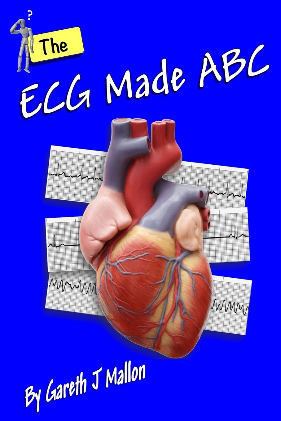 The ECG Made ABC