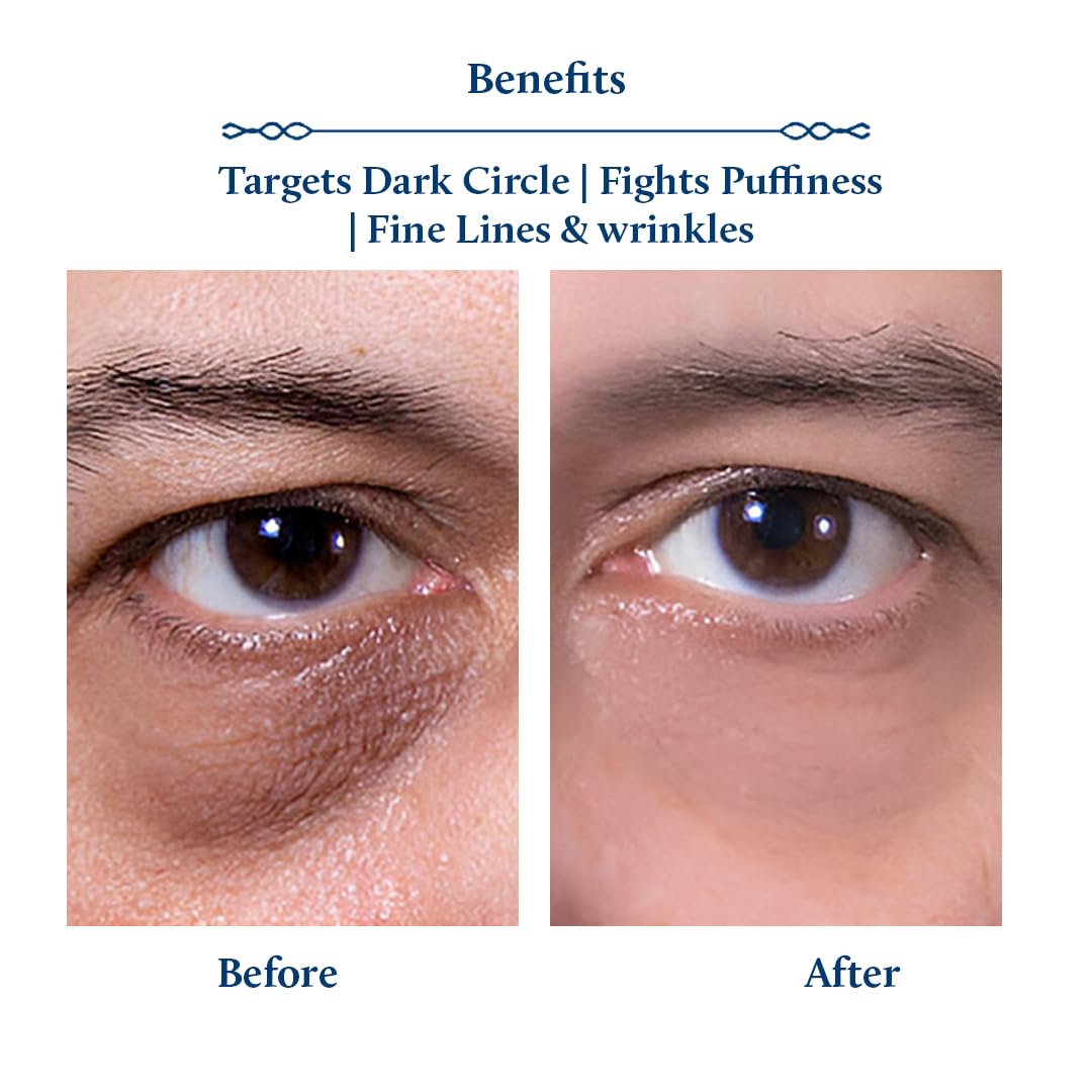 Blue Nectar Under Eye Cream for Dark Circles for Men, 15 g (Pack of 1) - Image 3