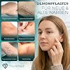 Silicone Scar Plaster 4 x 300 cm - Test Winner (Grade 1.2) Reusable Silicone Plaster for Scar Reduction After Caesarean Section Surgery Burns Acne & Keloids - UV-Resistant