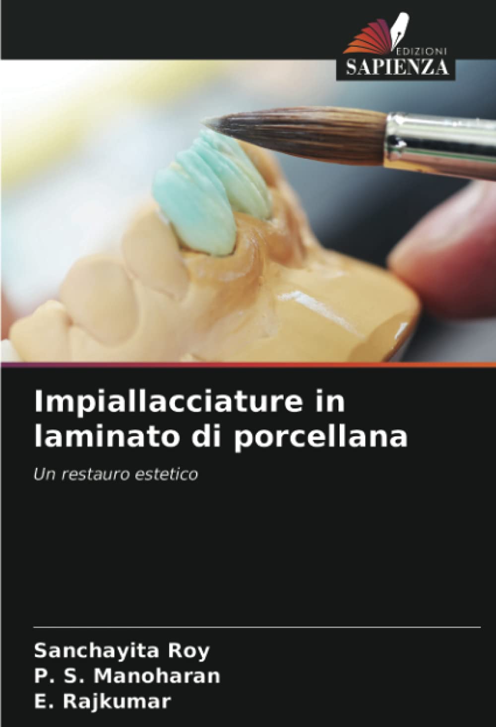 Impiallacciature in laminato di porcellana: Un restauro estetico