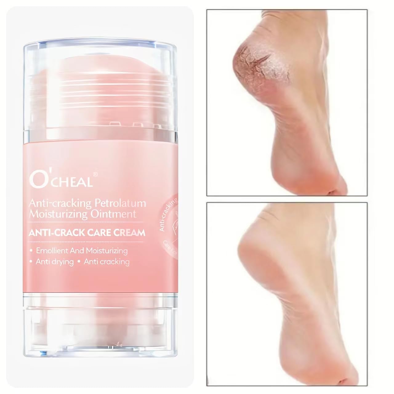 Cracked Heel Repair Cream Stick,Heel Balm Stick - Image 3