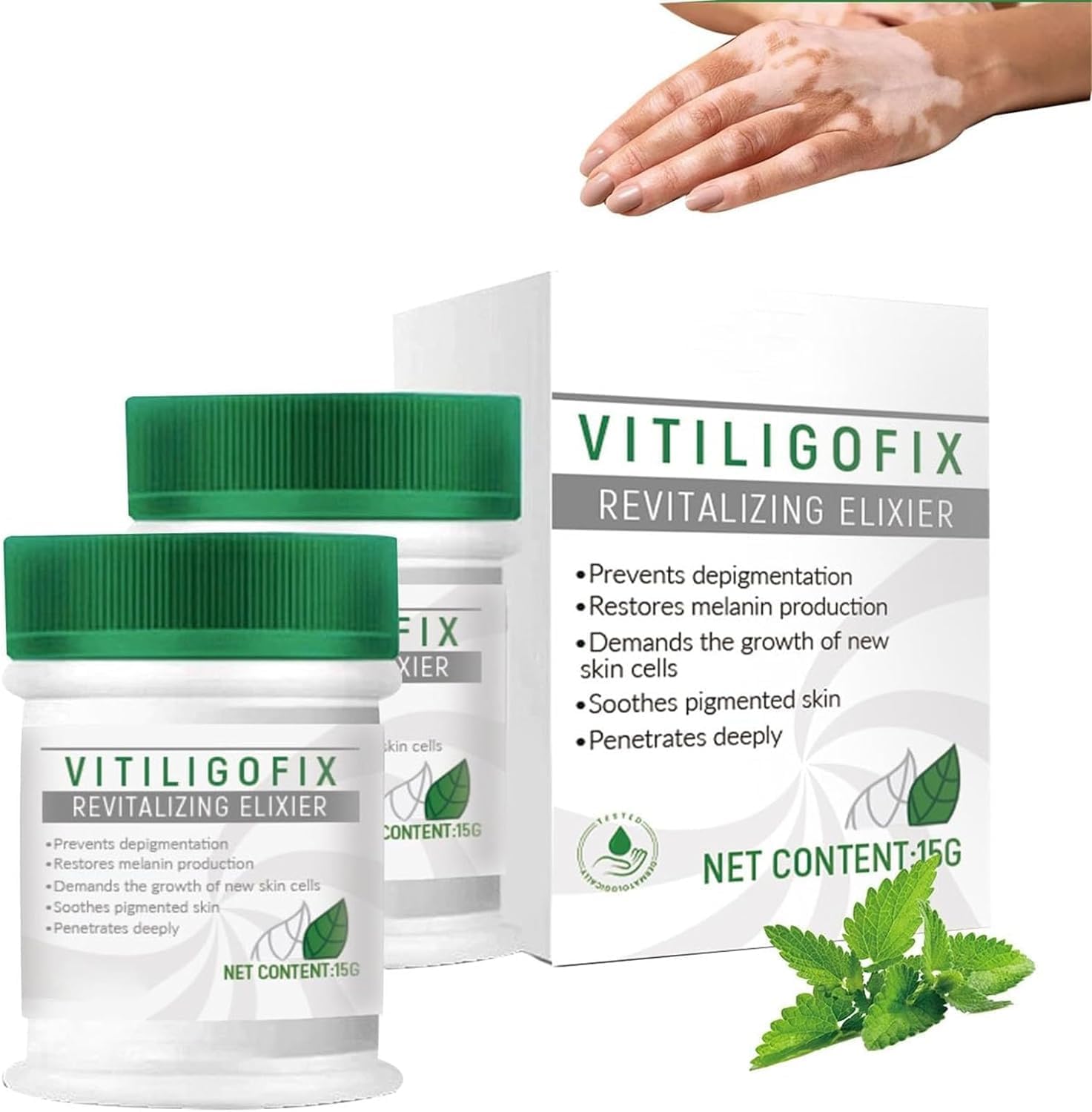 Heyangz 2Ps Vitiligo Treatment Recoloring Cream, Vitiligo Repair Revitalizing Essence, White Spot Removal Moisturizer, Reduce Vitiligo, Improve Skin Pigmentation