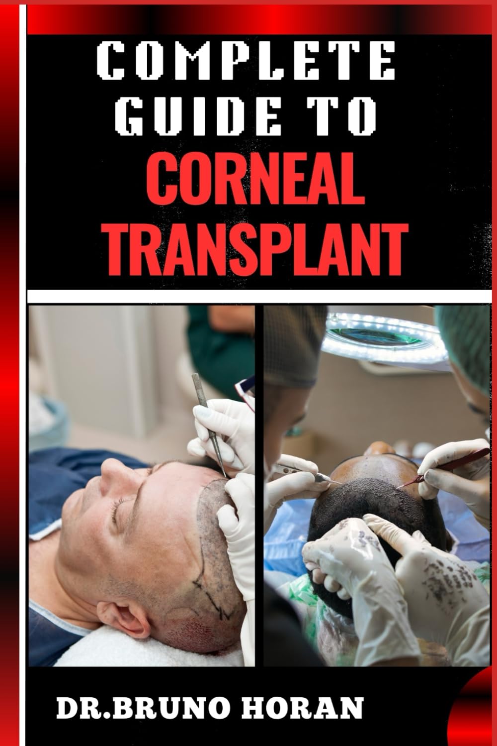 COMPLETE GUIDE TO CORNEAL TRANSPLANT: Essential Manual To Advanced Techniques, Patient Care, Recovery Tips, And Success Stories For Optimal Eye Health