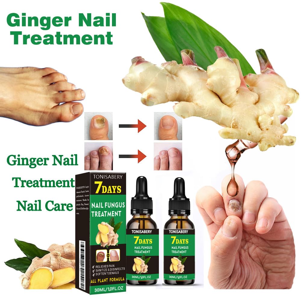 Nail Fungus Treatment for Toenail, 7 Days Nail Fungus Treatment Ginger Nail Fungus Treatment for Toenail Nail Nutrient Strengthener Ginger Nail Growth Oil for Natural Shine - Image 4