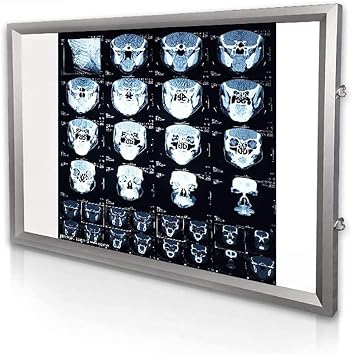LeTkingok X-ray Viewer Dental Orthopaedic Touch Control X-ray Film Illuminator Light Box 110V