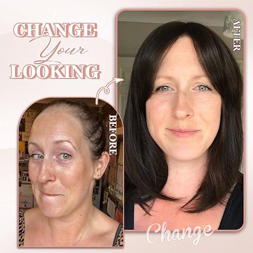 Miniatura 4 de Molefi Toppers para el pelo para mujer, 7 x 7 pulgadas, adornos de pelo corto para mujeres con cabello fino, sintético con cubierta de base grande,