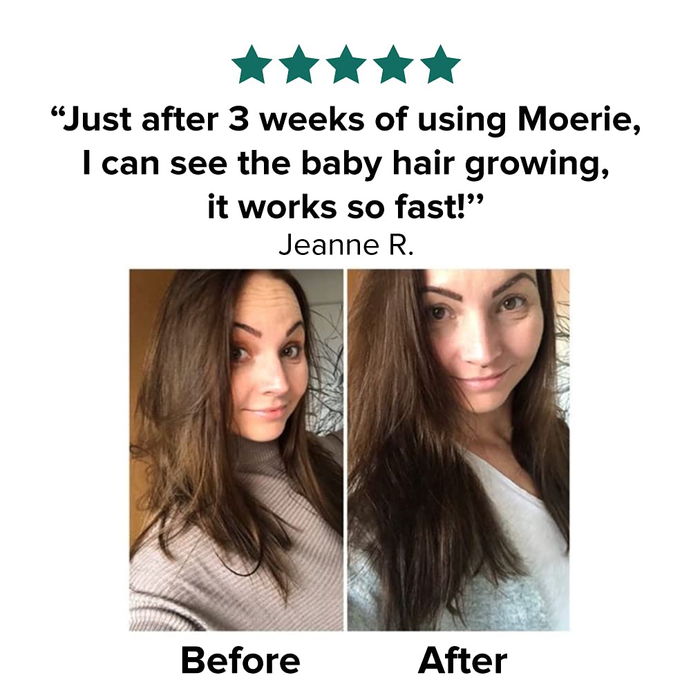 Moerie Ultimate Mineral Hair Growth Spray For Longer, Thicker, Fuller