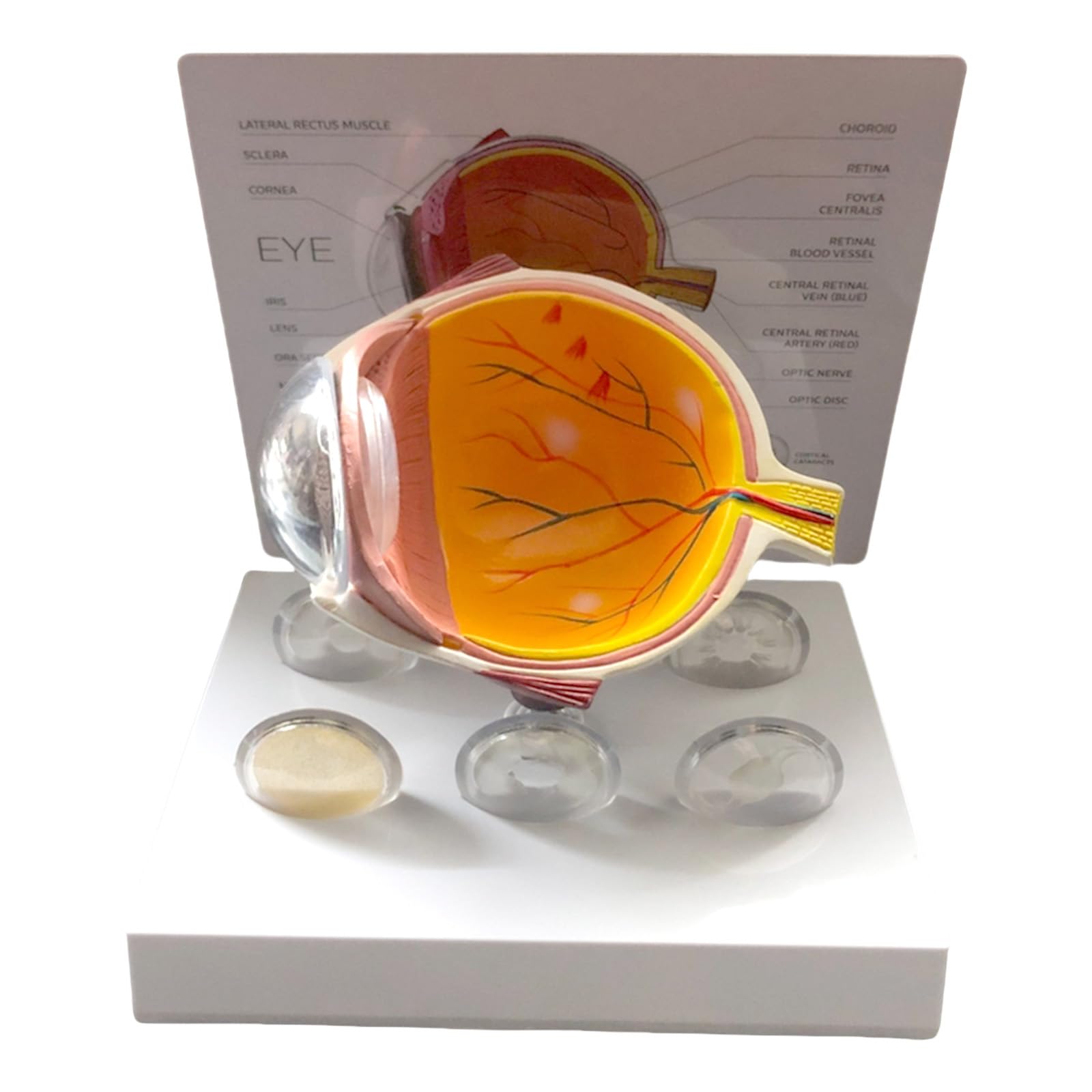 Modèle d'anatomie oculaire pour simplifier les cas cliniques complexes - 8