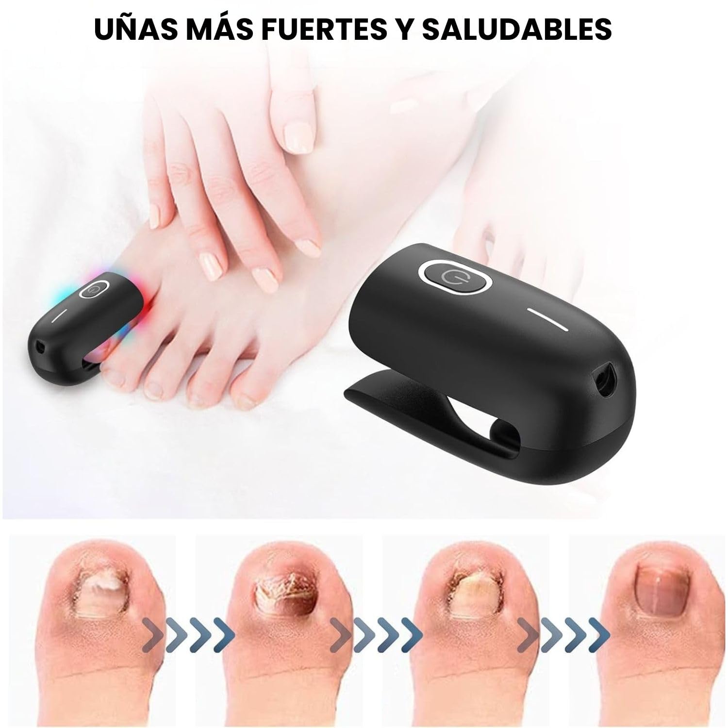 Tratamiento hongos uñas pies - Tratamiento Laser onicomicosis - antihongos - antifungico para uñas pies y manos - Eliminar micosis - potente tratamiento anti hongos - Quita hongos (Negro)