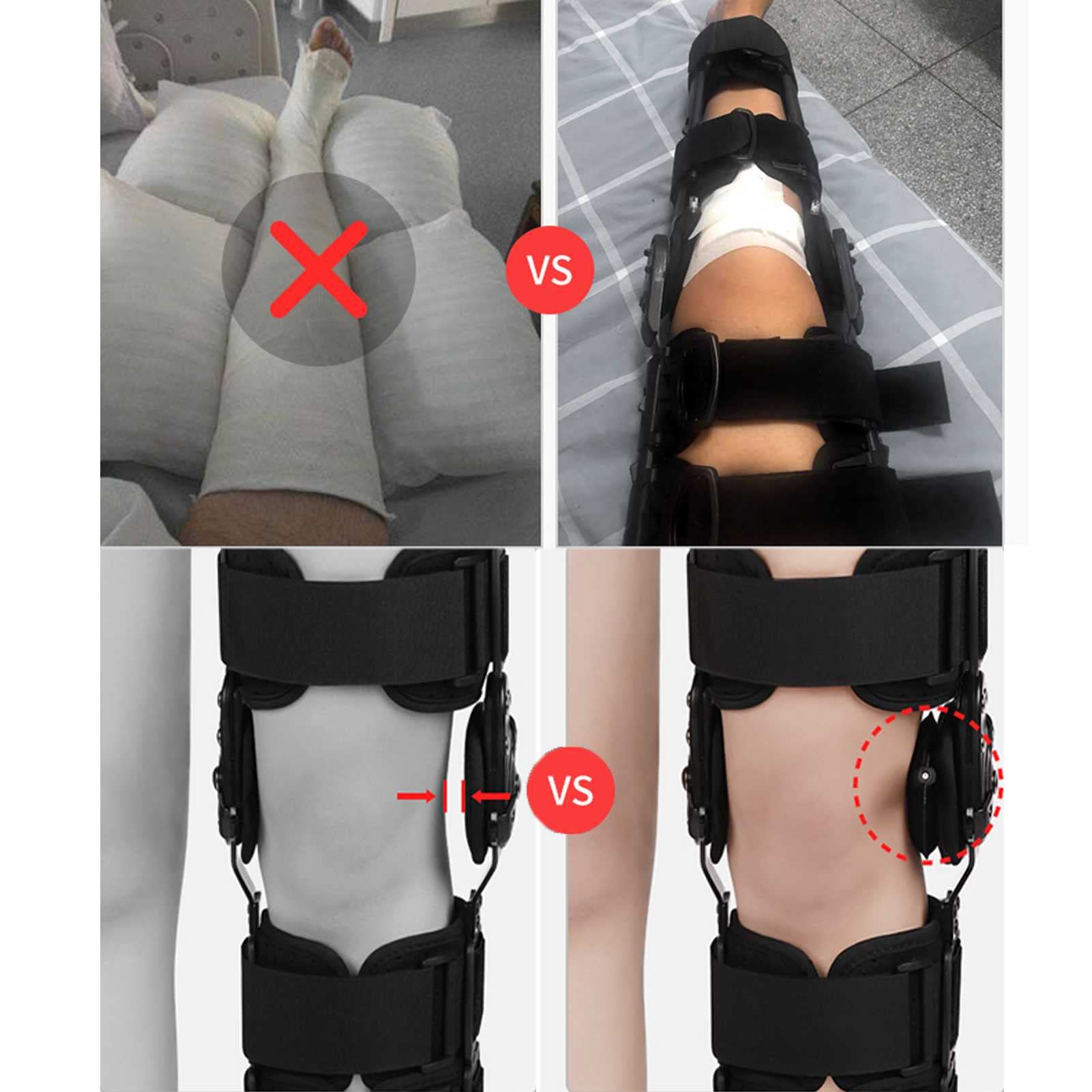 Dziecięcy Regulowany Stabilizator Kolana, Złamanie Łąkotki W Kolanie, Uraz Więzadła, Oddychający Stent, Krótki,B-M-Medium