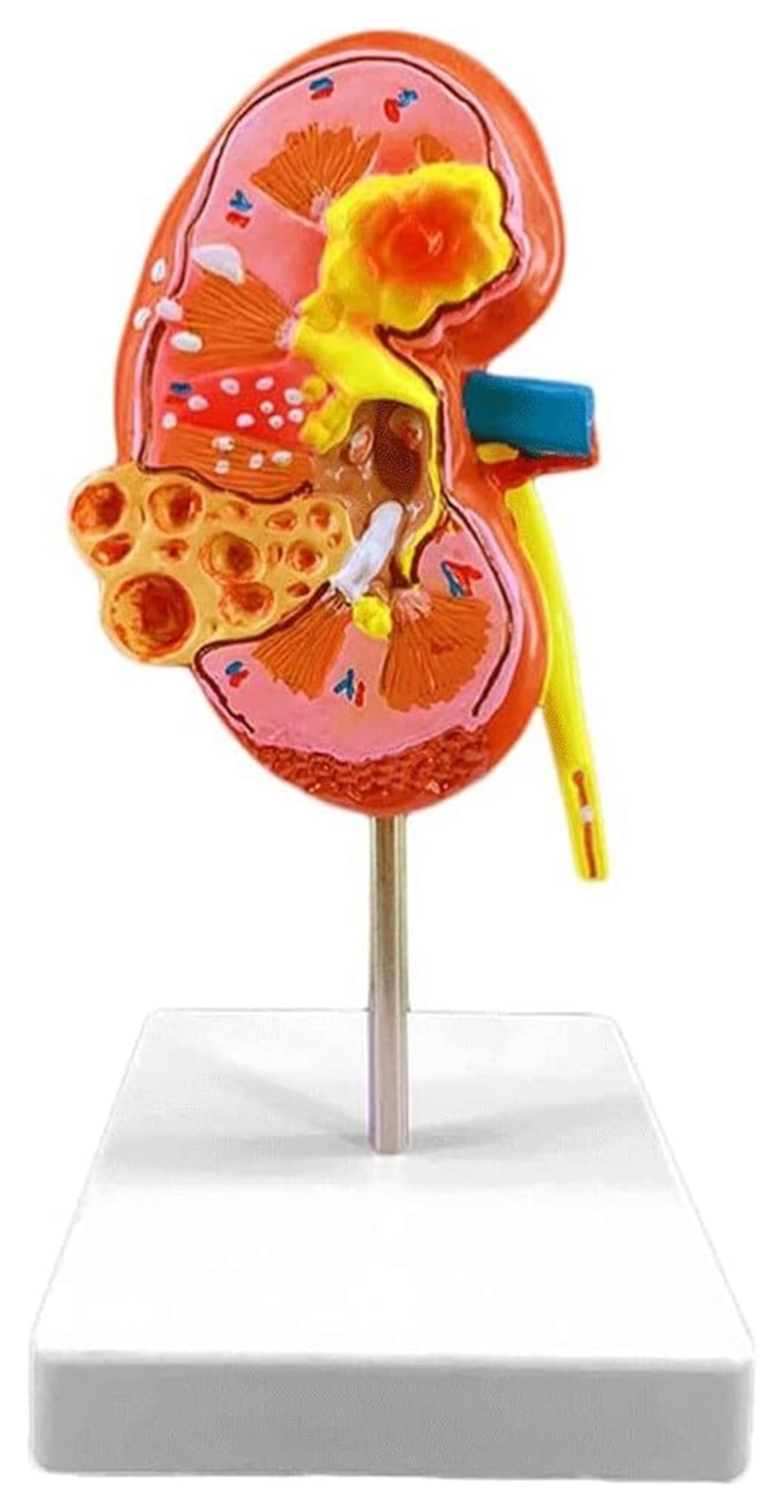 Anatomia Umana Organi Rene Rene Anatomia Macroscopica YouTube