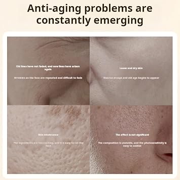 Qingling Wrinkle Removal Cream Japanese, Japan Qinglin Wrinkle Remover Cream for Face, Firming Anti-Aging Cream (2pcs)