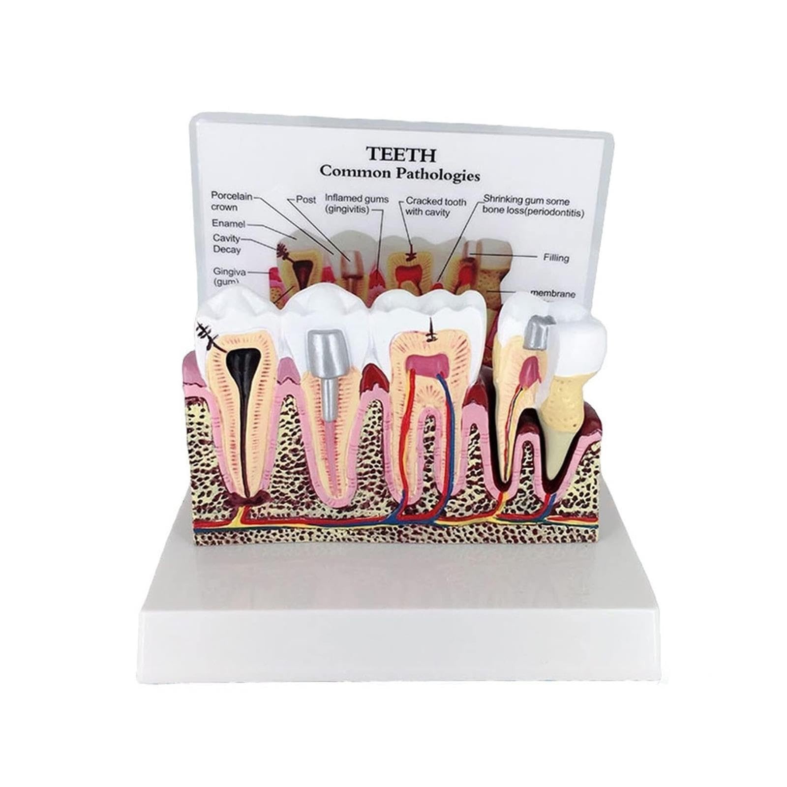 Anatomia dentale Educazione Modello Dente