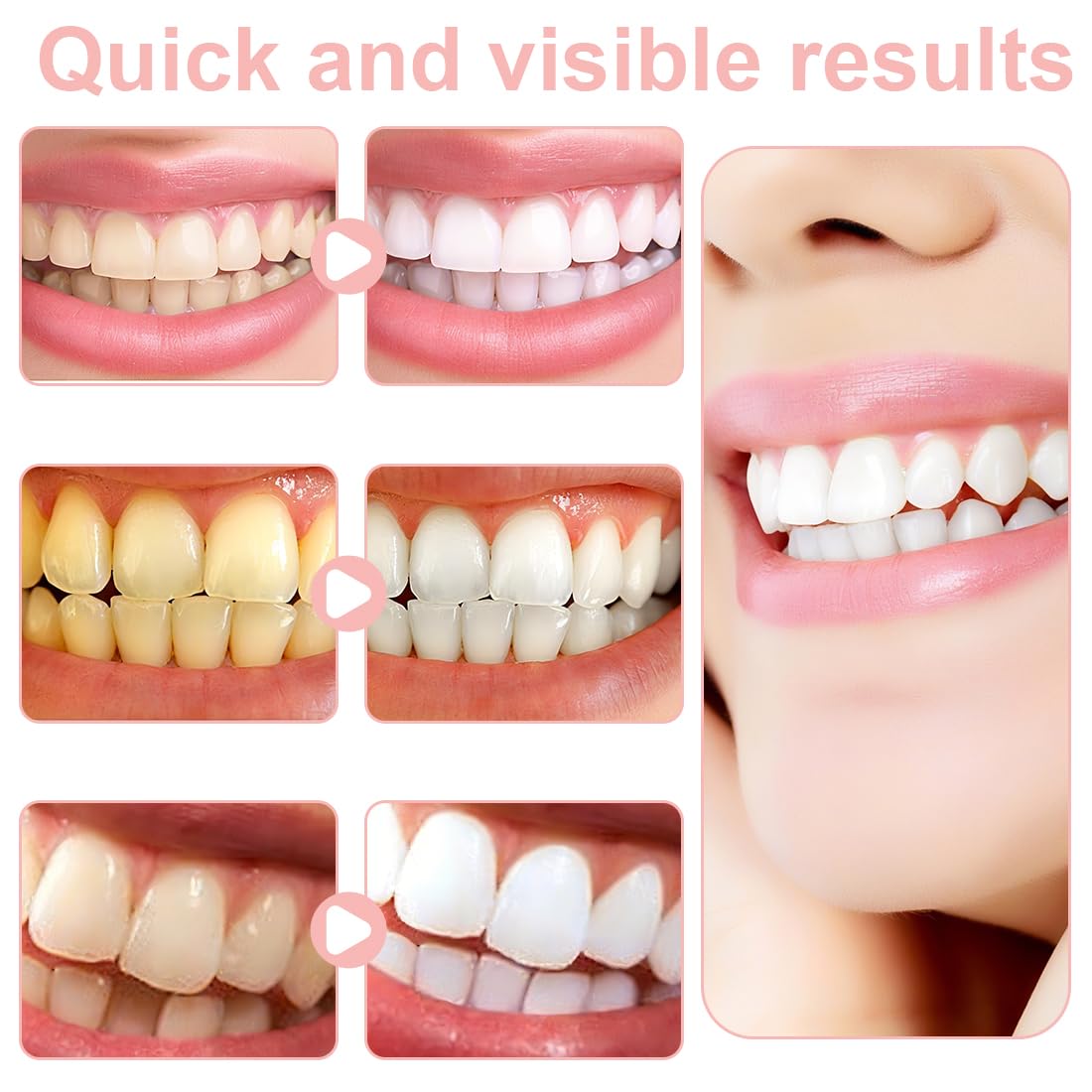 14pcs Steeth Whitening Strips,triscia Sbiancante Denti Strisce Sbiancanti Denti,Per un Sorriso Luminoso e Naturale,Elimina Tache Ostinate di Caffè, Vino e Tabacco