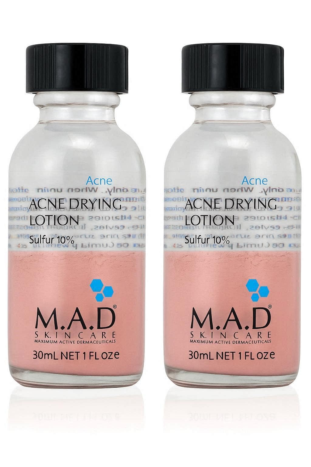 M.A.D Skincare Acne Drying Lotion - Intensive Overnight Spot Treatment [2 Pack]