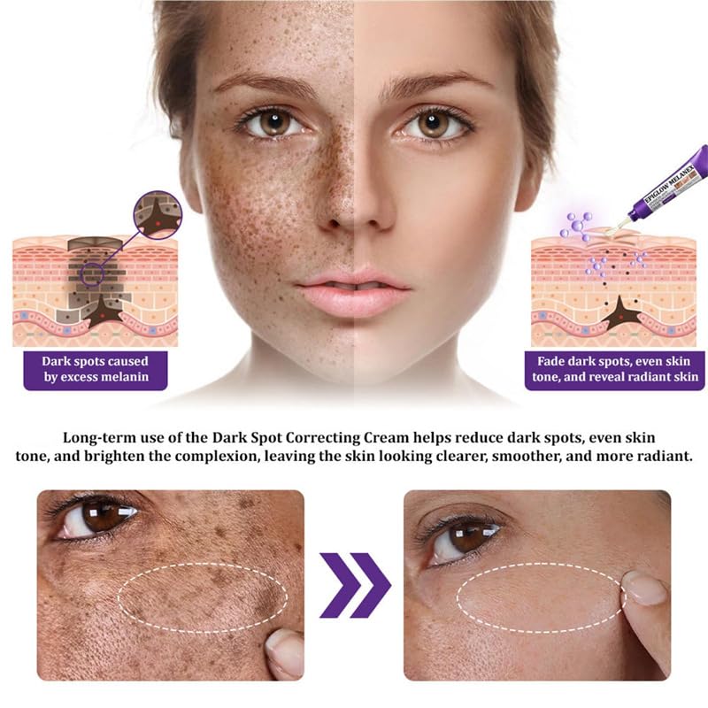 Crème anti-hyperpigmentation efficace avec collagène naturel anti-taches universel - 6