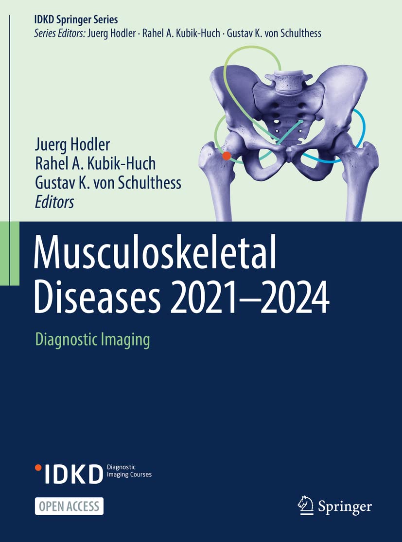 Buy Musculoskeletal Diseases 2021-2024: Diagnostic Imaging (Idkd Springer Series) — BookShops.in