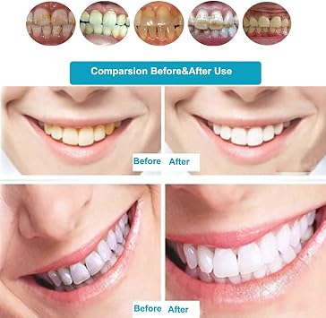 Dental Mobile Teeth Whitening Lamp with 8Pcs LED Cold Blue Light Tooth Whitening Bleaching Accelarator 24W