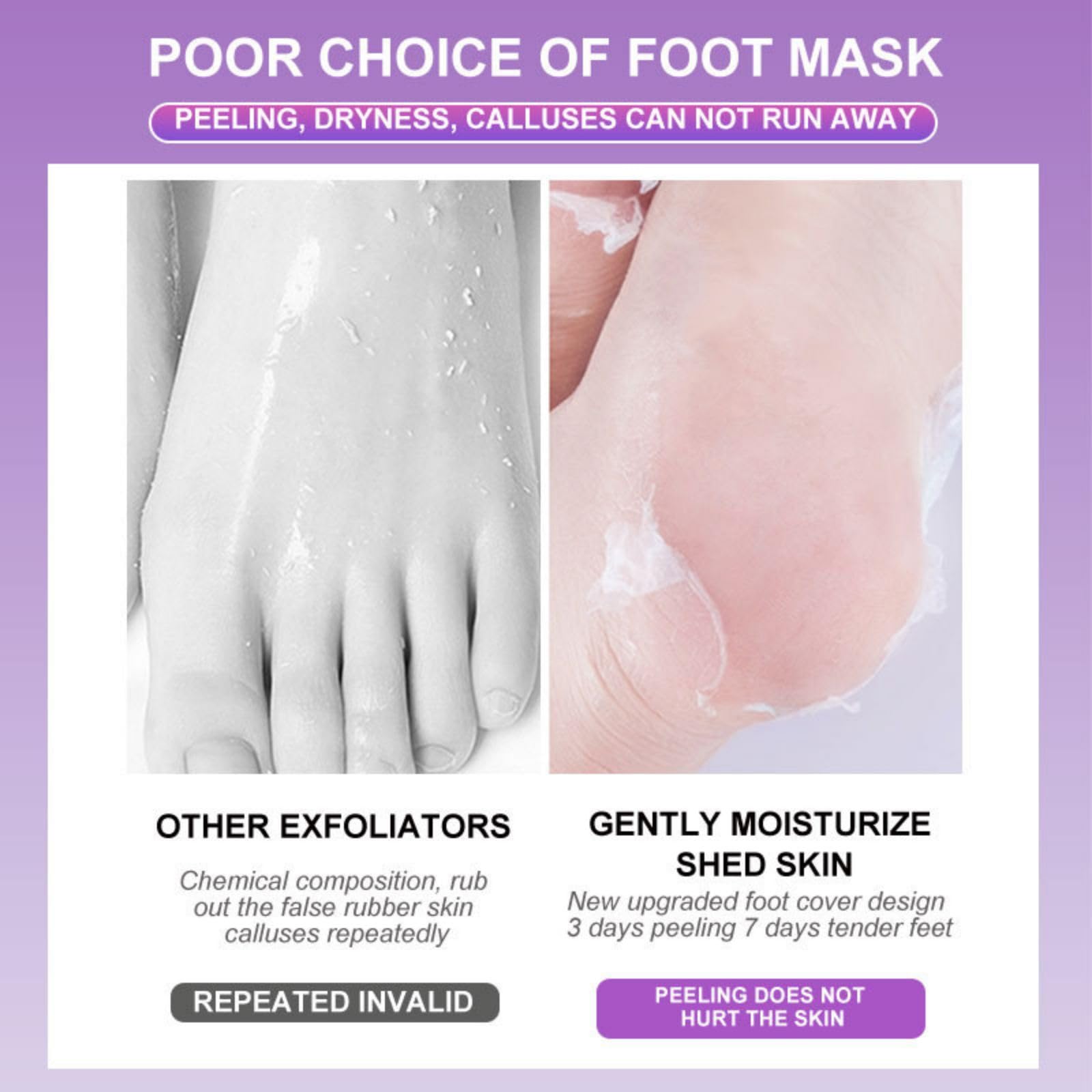 Joyeee Maschera Piedi Esfoliante, Lavender Foot Peel Mask, Efficace Peeling Piedi, Scrub Piedi e rimozione Calli dei Piedi, per Uomini e Donne, 5 paia