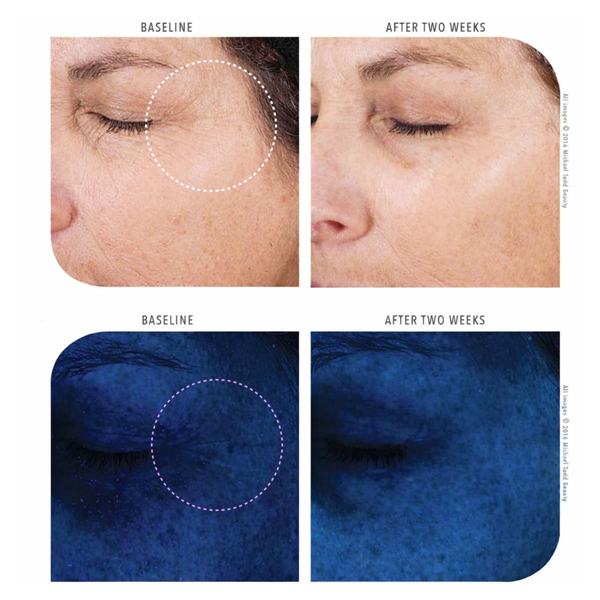 Michael Todd Beauty KNU Serum - Face Lifting, Brightening & Tightening