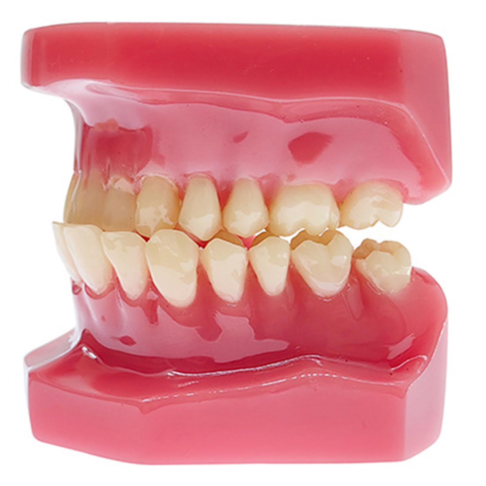 Modello di Denti Tipodonti - Modello Ortodontico - per La Didattica E Lo Studio della Facoltà di Odontoiatria, Rosso, 6 Cm (Rosso 6 Cm),Red-6cm