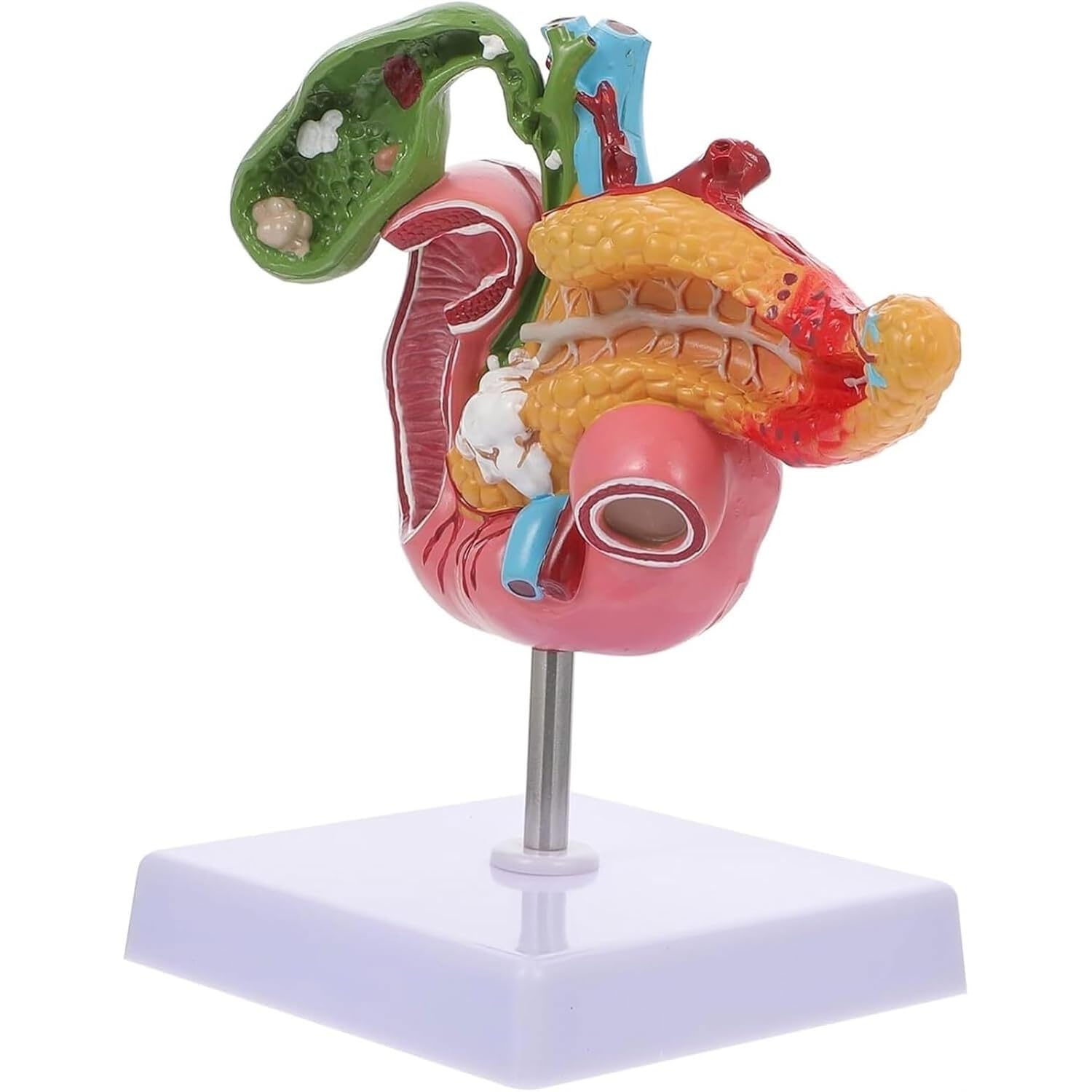 Chirurgie des calculs biliaires Système de gastroentérologie Modèle hépatobiliaire Modèle pathologique de la vésicule biliaire Modèle d'enseignement de la biologie Pancréas médical Duodénum Modèle
