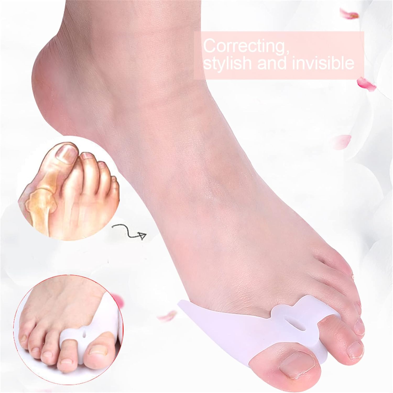 Bunion Corrector & Bunion Relief Protector Sleeves Kit, Pain Relief Bunion Protector Sleeves Hallux Valgus Straighteners Bunion Corrector Set for Hallux Valgus