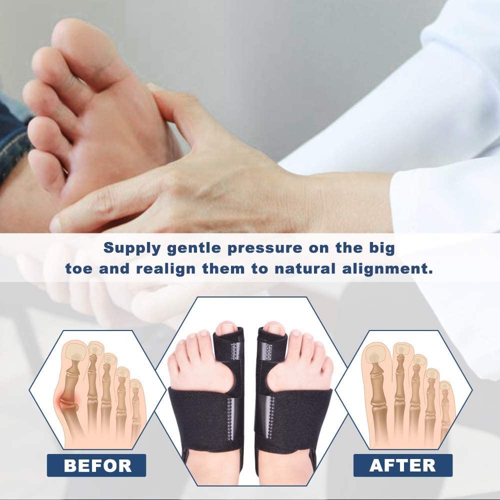 sainio Bunion Corrector Bunion Splint Big Toe Straightener for Hallux Valgus Pain Relief Fits Men and Women