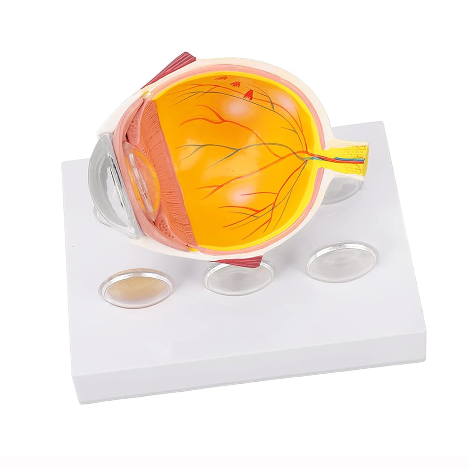 Amazon.co.jp: 白内障眼球模型、人体解剖生理学教育用白内障状態