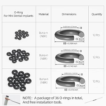 O-Ring, Buna-n, Tool Kit with 3 Convenient Sizes, Replacement for Mini Dental Implants
