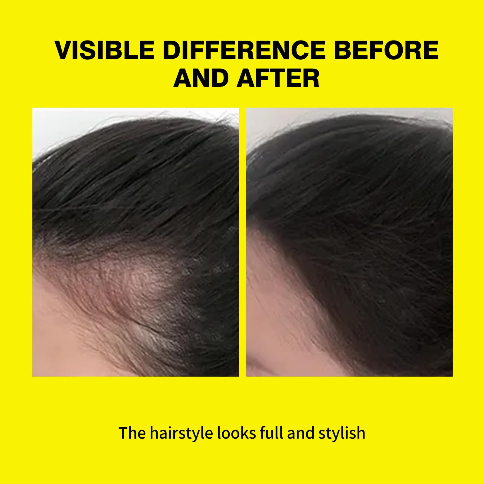 SEVICH 2-in-1 Hairline Powder & Volumizing Powder for Gray Coverage & Fluffy Roots, Oil-Absorbing, Natural-Looking - Image 4