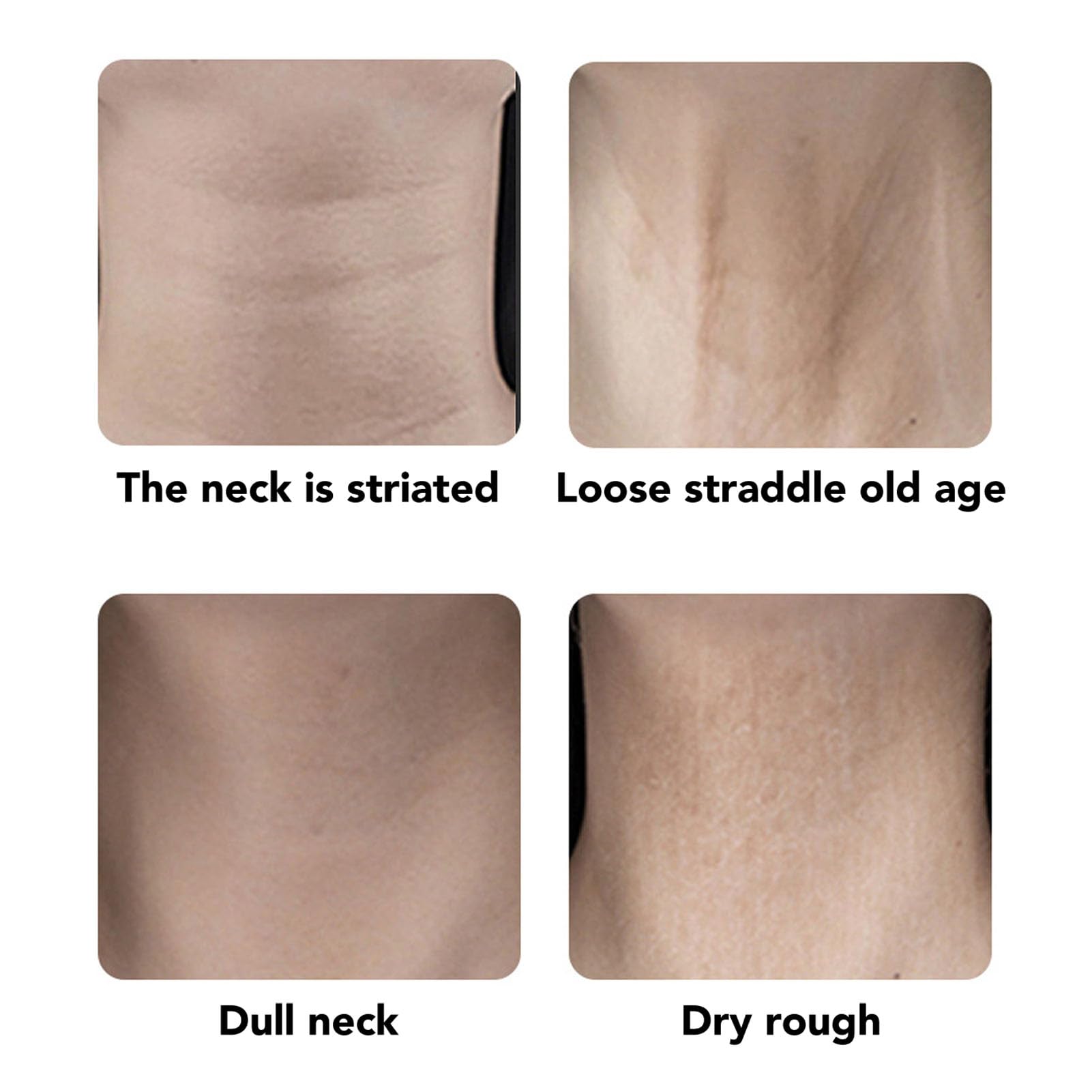 Cinta De Estiramiento Facial, Cinta De Levantamiento De Cuello Y Cara Que Elimina Las Arrugas, Adhesivo Impermeable Para El Cuello, Parche De Estiramiento Facial, Color De Piel Para Ocultar Arrugas Fa