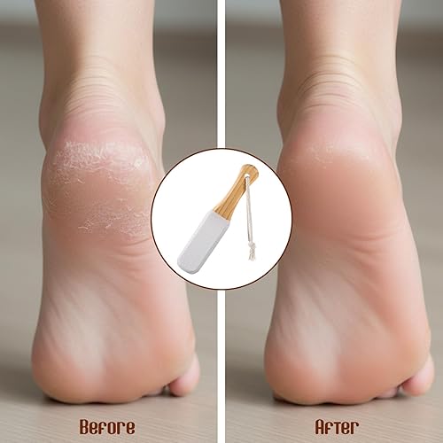 Miniatura 3 de Paquete de 2 piedras pómez para pies, lima de pies, removedor de callos con mango de madera, raspador para callos y pedicura, limador de pies para