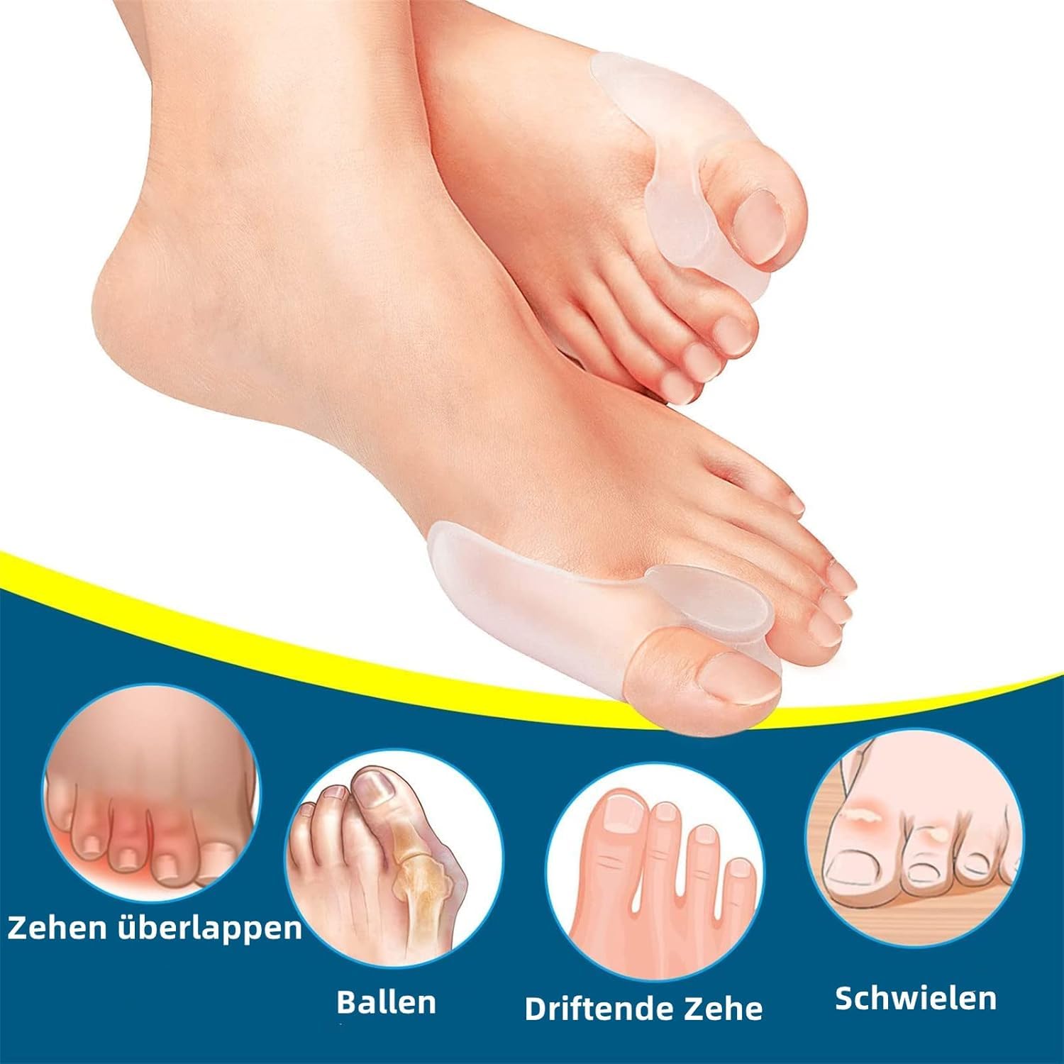 KANISYA Silicone Bunion Protector for Toe Pain Relief | Gel Toe Separator & Hallux Valgus Corrector, Soft Bunion Pads for Men & Women, Comfortable & Reusable Foot Care Sleeves (1 Pair) 1