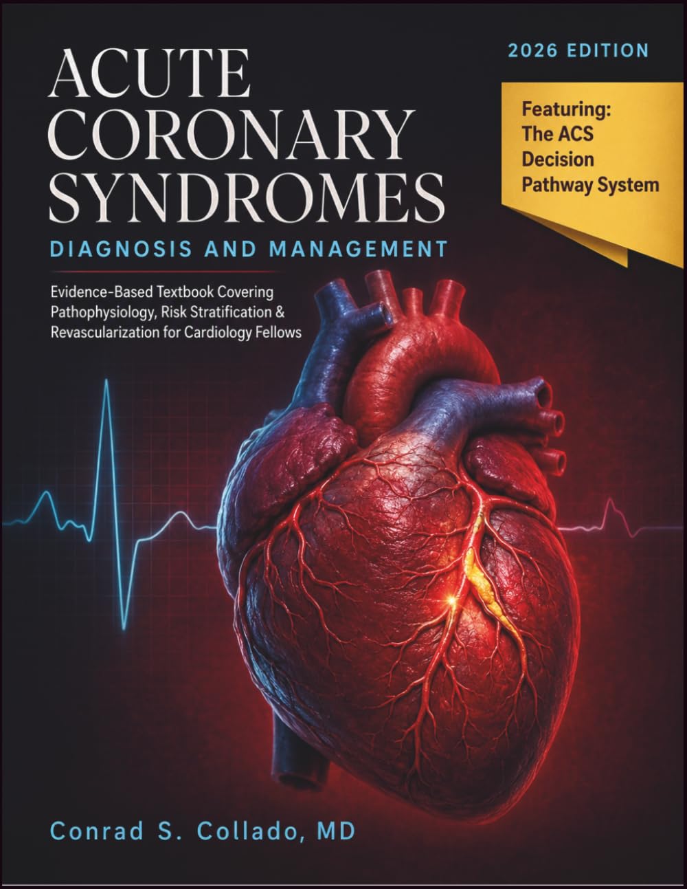 Acute Coronary Syndromes Diagnosis and Management: Evidence-Based Textbook Covering Pathophysiology, Risk Stratification & Revascularization for Cardiology Fellows