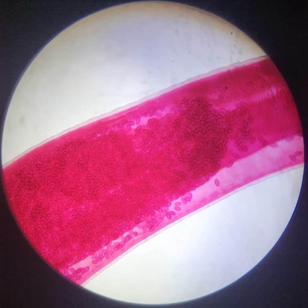 1 Pieces Trichuris Trichiura Adult Microscope Prepared Slides Whipworm Females w.m or Whipworm Males w.m (Whipworm Females w.m)
