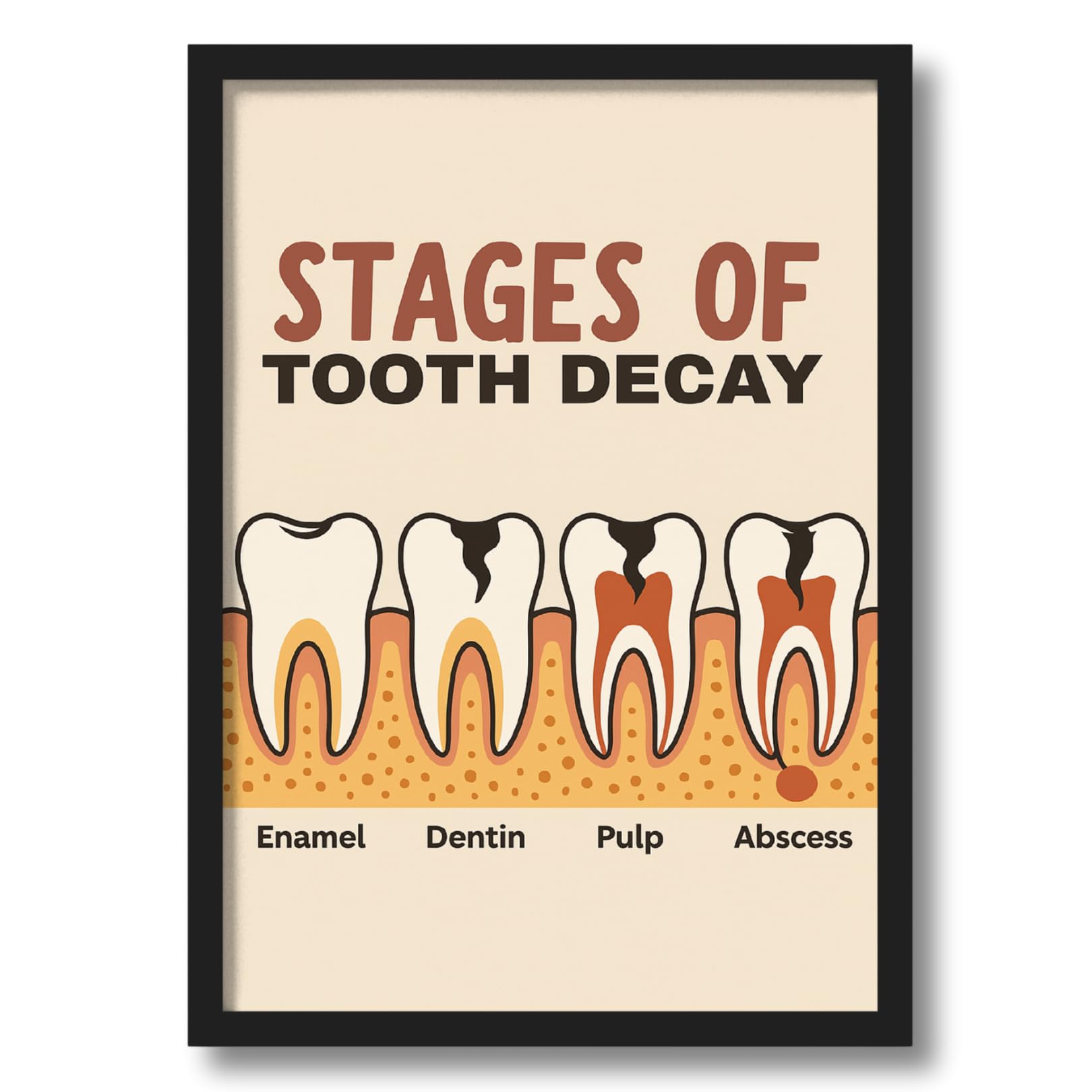 ArtAction Dental Poster Wall Frame | Enamel, Dentin, Pulp, Abscess A4 Size Framed Poster for Dental Clinics, Living Room, Office | Educational Wall Decor Gift for Dental Professionals