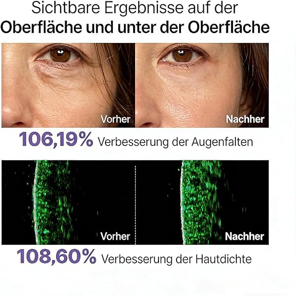 Maison Deep Collagen Serum, Maison Cosmetics Kollagen Serum, Anti-Aging Serum zur Glättung Feiner Linien & Falten, Feuchtigkeit & Straffende Hautpflege, Korean Skincare Serum für Alle Hauttypen (1) - 4