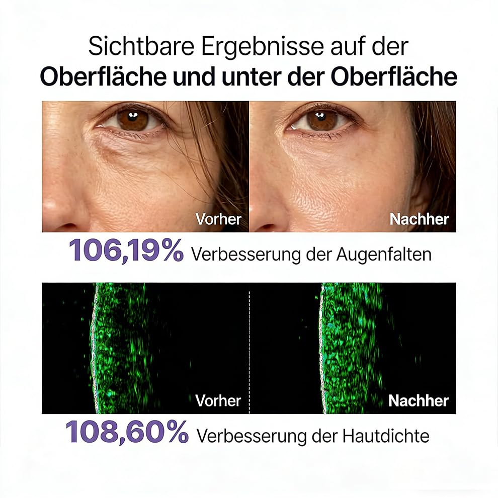 Maison Deep Collagen Serum, Maison Cosmetics Kollagen Serum, Anti-Aging Serum zur Glättung Feiner Linien & Falten, Feuchtigkeit & Straffende Hautpflege, Korean Skincare Serum für Alle Hauttypen (1) - 5