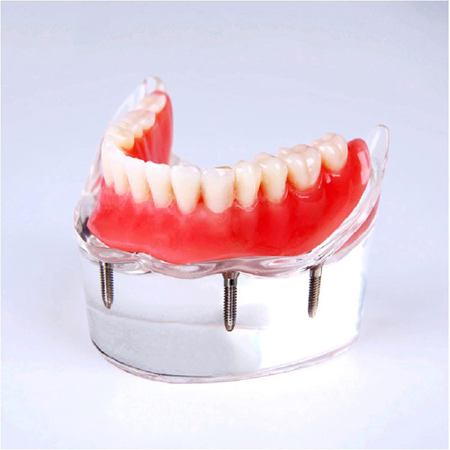 Modello Anatomico, Modello Scheletrico, Modello di Denti Implantari, Modello Didattico per Studio Odontoiatrico, per Protesi su Impianti E Unghie, Modello di De