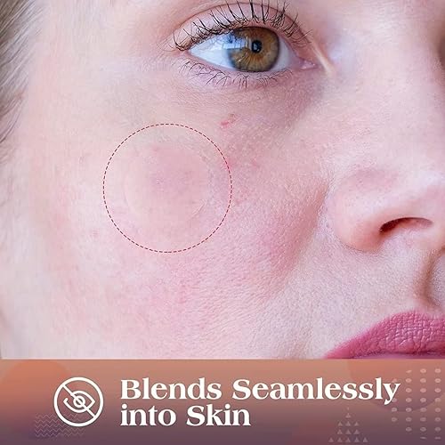 Miniatura 2 de AUSLKA Parches de imperfecciones -175 parches - Puntos hidrocoloides - Parche de manchas - Calcomanías para espinillas, para parche de cubierta