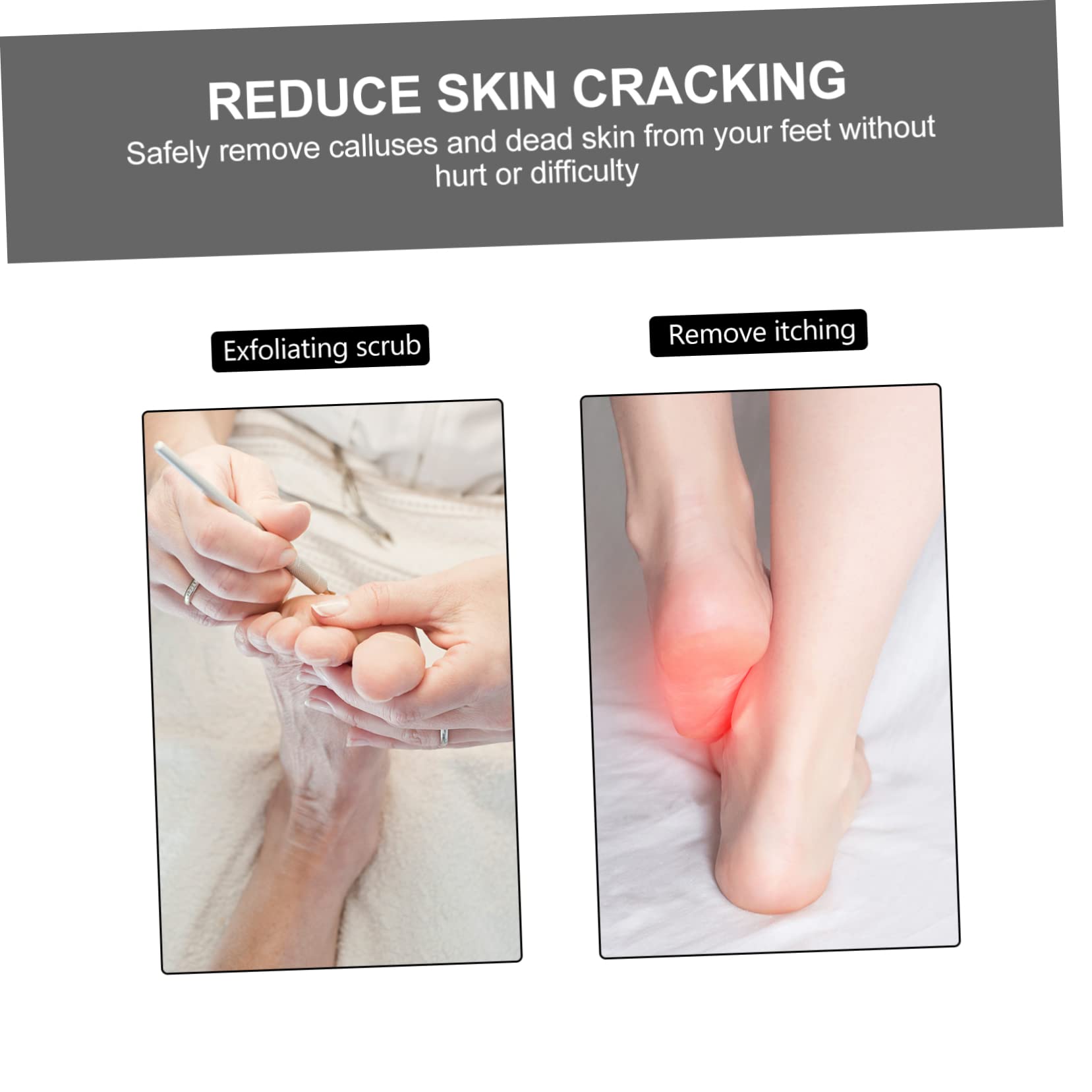 FRCOLOR 5 unidades de exfoliante de piel muerta raspador de pies raspador de callos kit de pedicura para los pies Pedicure-Peling-Oferta Lima de pies Manual de Tabla de Pies Removedor de Pie Lavado