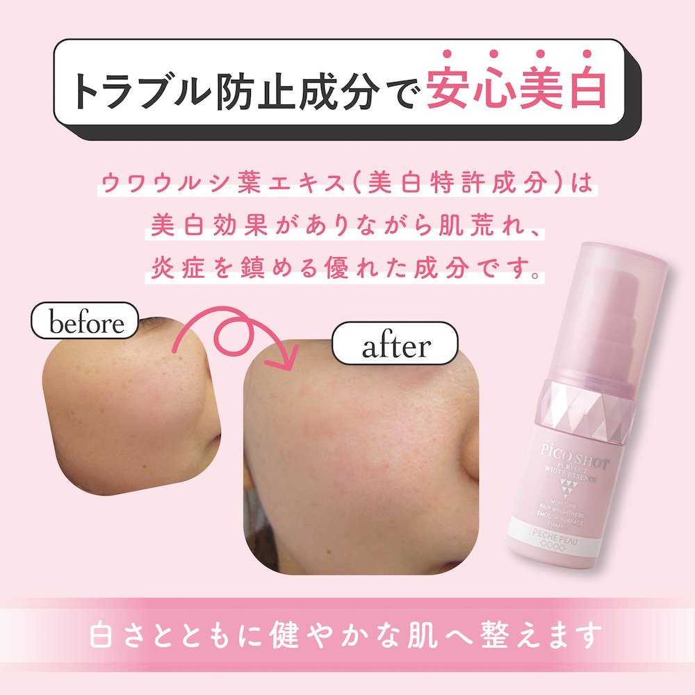 Amazon.co.jp: 濃厚ホワイトエッセンス : ビューティー