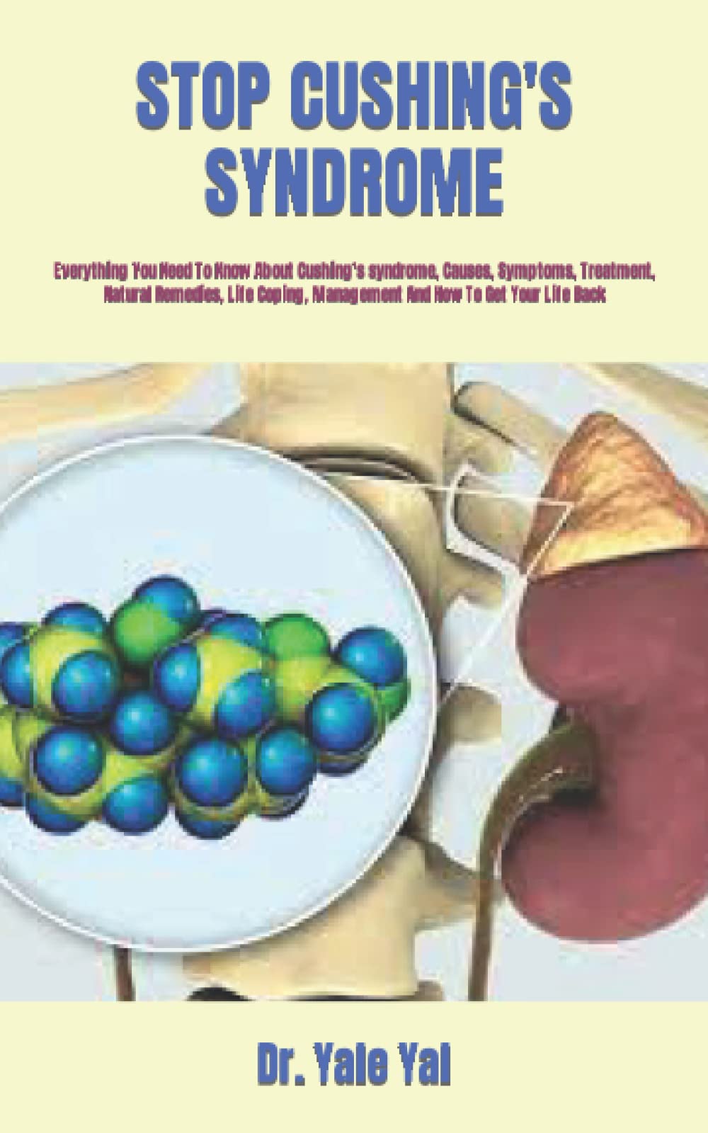 Buy STOP CUSHING'S SYNDROME Everything You Need To Know About Cushing