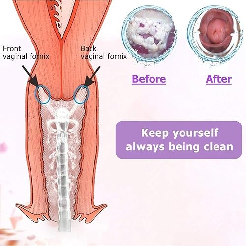 Miniatura 4 de Sistema de limpieza vaginal reutilizable excelente limpiador vaginal femenino enjuague vaginal, limpieza manual a presión, 100% seguro, 10.1fl oz