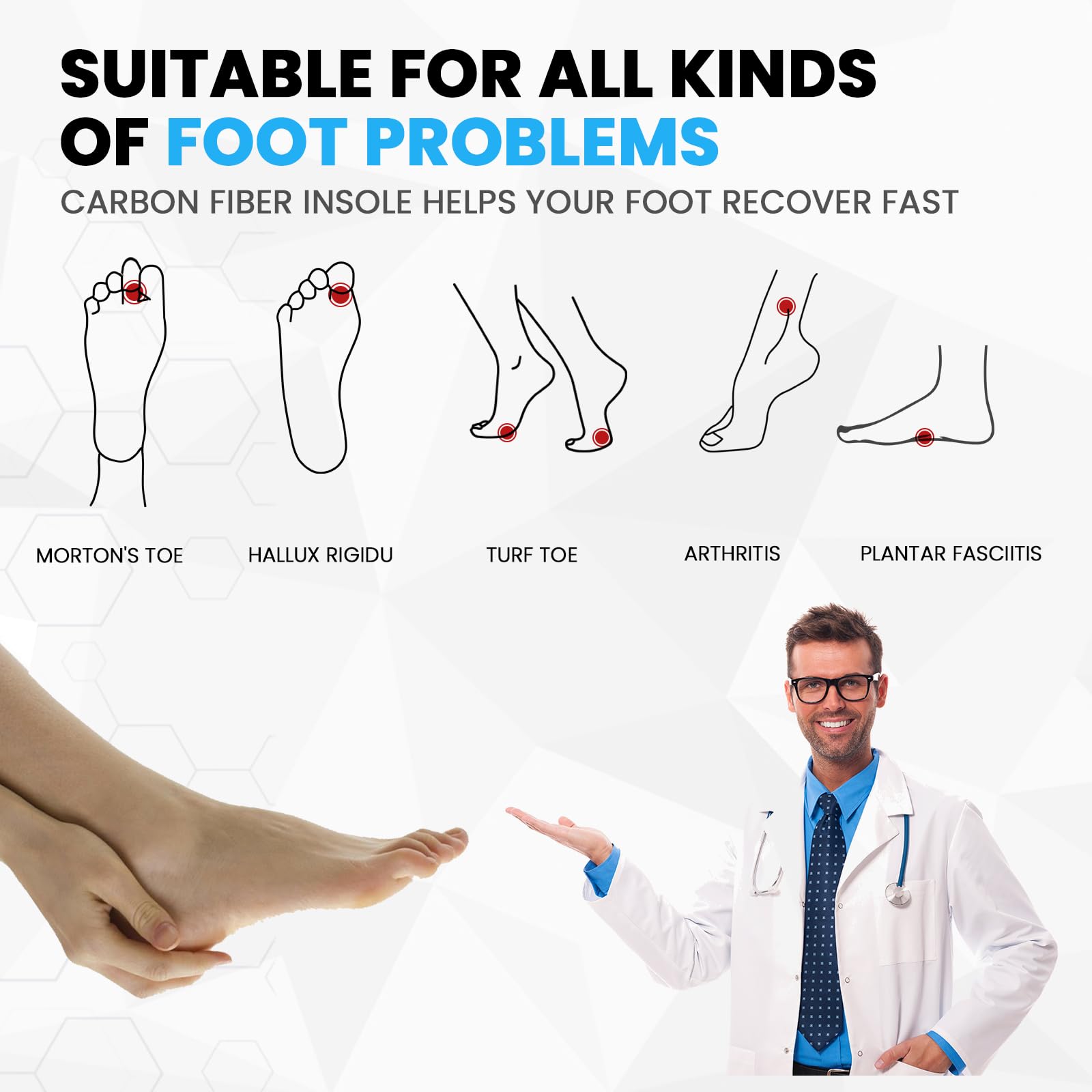 Semelles en fibre de carbone pour hommes et femmes - Sumiwish (1 paire) - Support rigide pour arche haute et rigidité - Support rigide pour l'hallux rigidus, l'hallux rigidus, le morton toe - XS