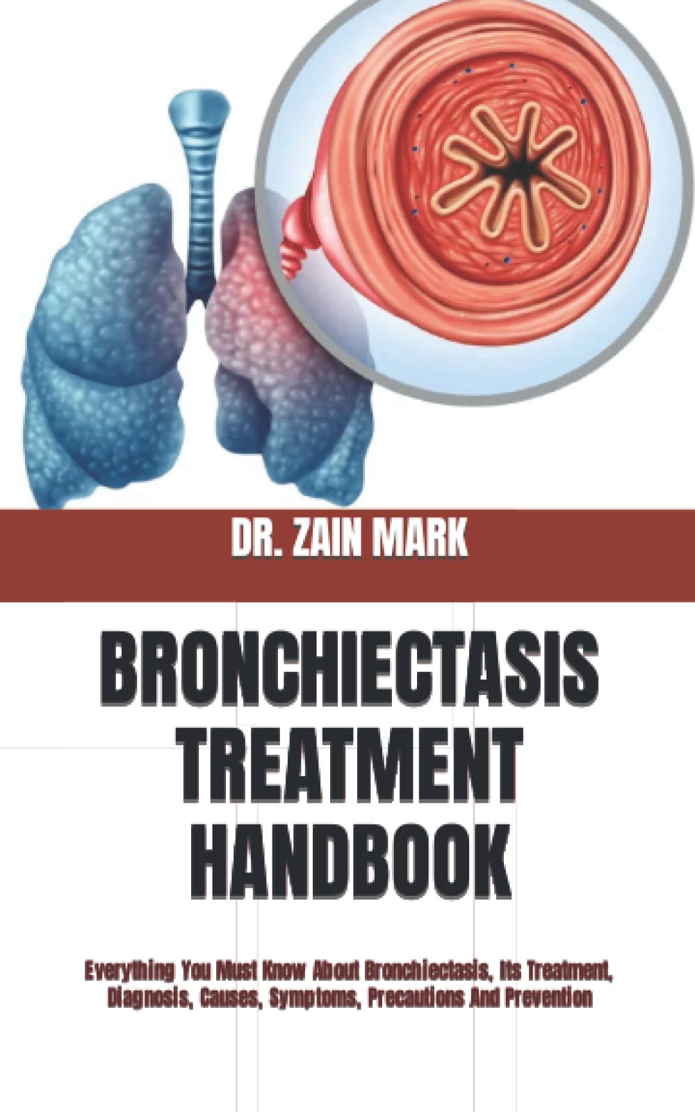 BRONCHIECTASIS TREATMENT HANDBOOK: Everything You Must Know About Bronchiectasis, Its Treatment, Diagnosis, Causes, Symptoms, Precautions And Prevention