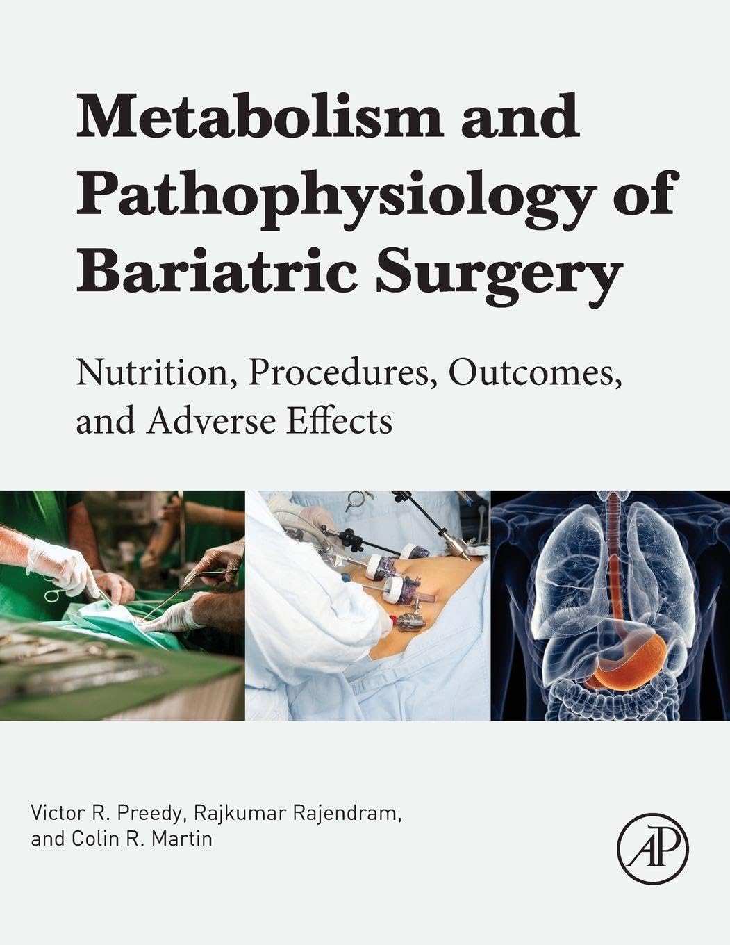 Buy Metabolism and Pathophysiology of Bariatric Surgery: Nutrition, Procedures, Outcomes and Adverse Effects — BookShops.in