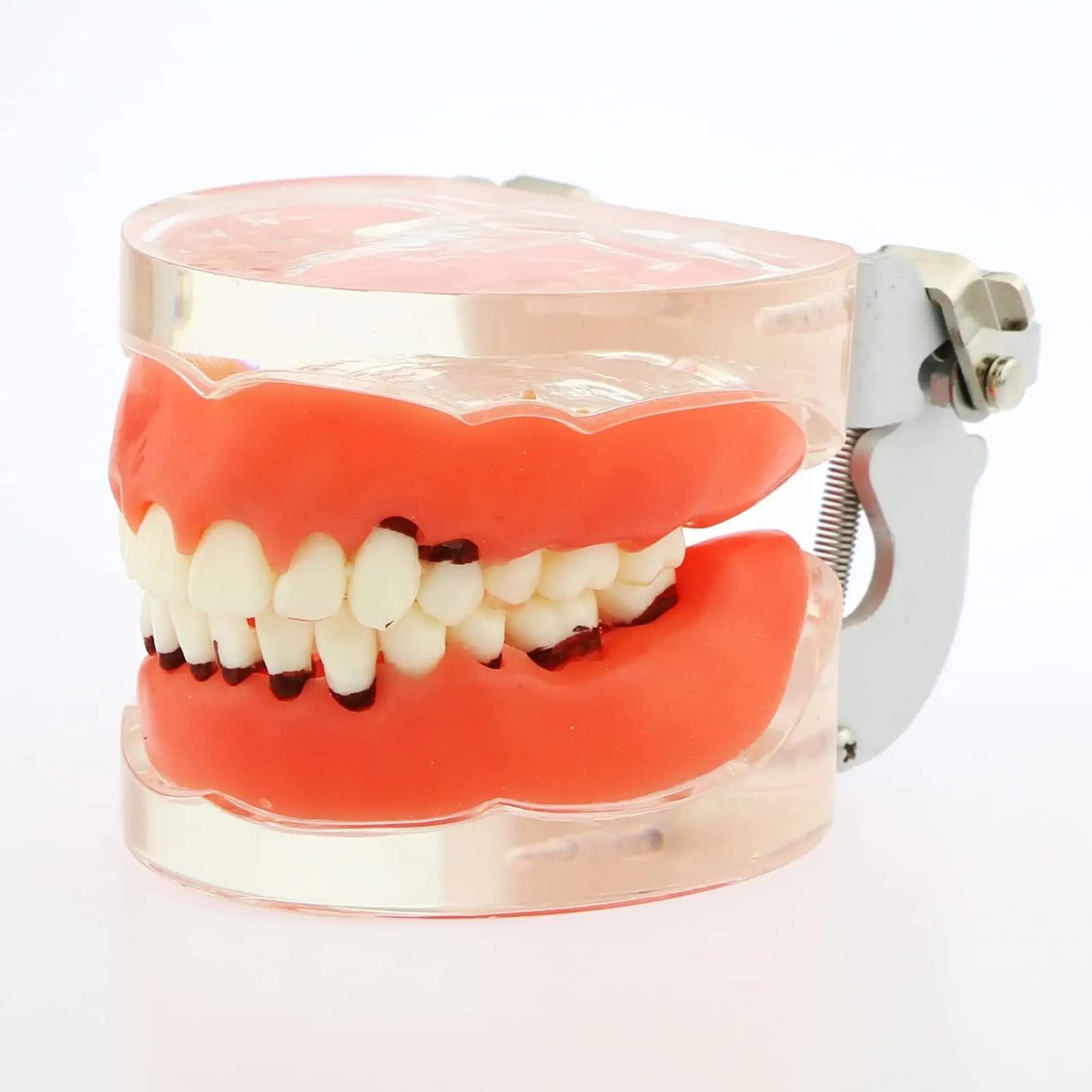 Modello Denti per Malattia Parodontale per Studio Odontoiatrico, Typodont con Gomme Morbide per Insegnamento e Formazione in Odontoiatria, Strumento Educativo Anatomico